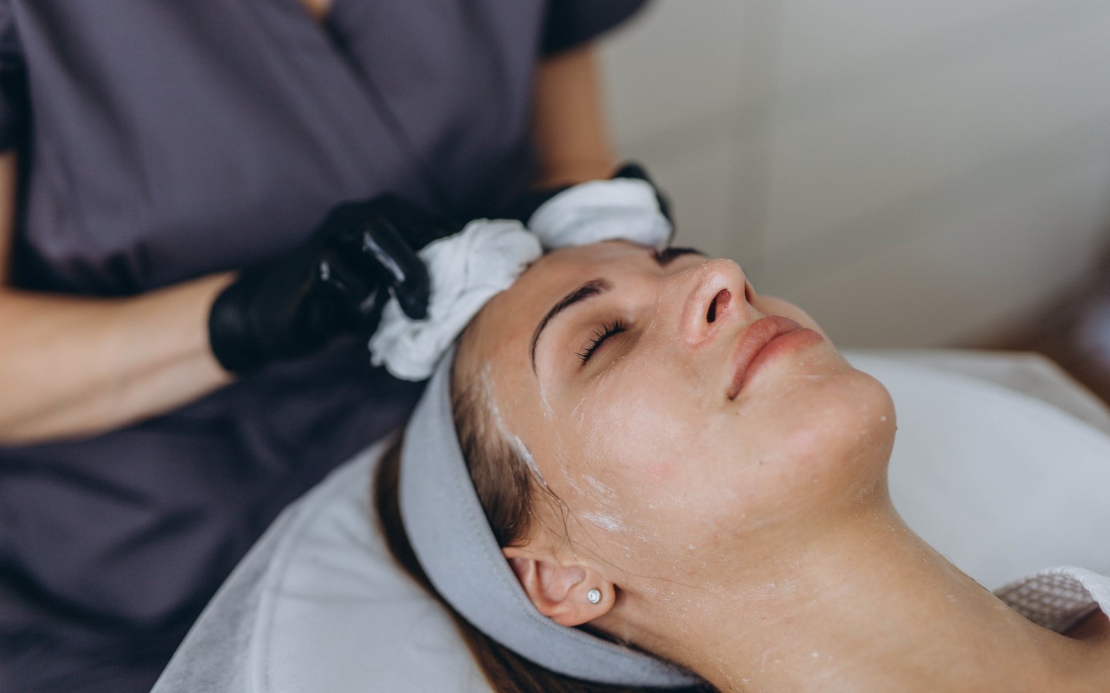 Chemical Peel at Elite Spa