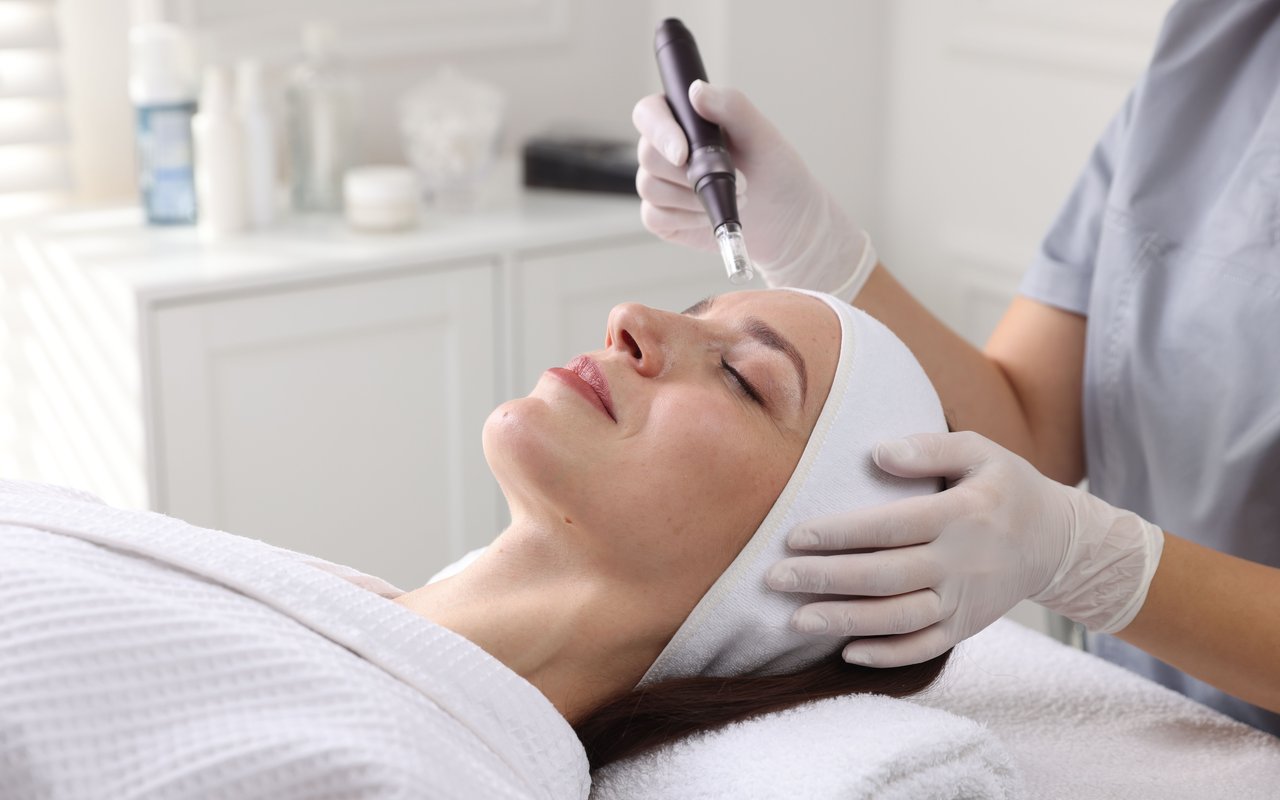 Microneedling at Elite Spa